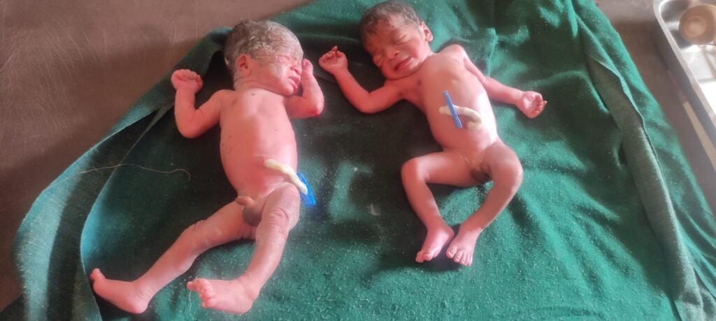 <em>आंगनबाड़ी केंद्रों में केले एवं अंडे का वितरण किया गया शुरू, सुपोषित अभियान के तहत किया गया यह बदलाव, शक्ति कलेक्टर नूपुर के हेल्थ मिशन से संवर रहा है शक्ति जिला</em> kshititech