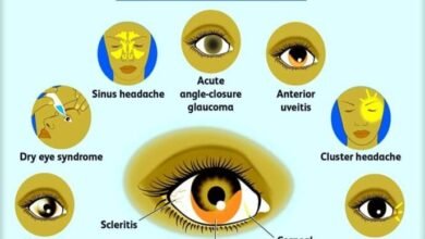 <em>निशुल्क नेत्र चिकित्सा जांच शिविर-- बाराद्वार की मारवाड़ी युवा मंच जागृति शाखा का 3 सितंबर को अग्रसेन भवन में होगा निशुल्क नेत्र रोग मोतियाबिंद जांच एवं परामर्श शिविर,एमजीएम नेत्र संस्थान की टीम रहेगी अध्यक्ष श्रीमती नेहा सावडिया एवं सचिव श्रीमती रितु जिंदल ने दी जानकारी</em>, अध्यक्ष नेहा ने कहा-- आर्थिक रूप से कमजोर लोगों का निशुल्क करवाया जाएगा मोतियाबिंद ऑपरेशन kshititech