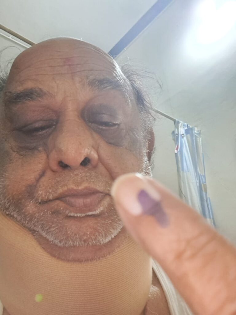 <em>विधायक प्रत्याशियों की किस्मत EVM में कैद, 3 दिसंबर को खुलेगी किस्मत,छत्तीसगढ़ में औसतन 70% मतदान की संभावना, निर्वाचन आयोग की सजगता से शादी- विवाह की तरह सजे रहे पोलिंग बूथ,शक्ति जिले में शांतिपूर्ण संपन्न हुआ मतदान, नव मतदाताओं में दिखा उत्साह तो वहीं दिव्यांगों ने भी किया मतदान, चरणदास में सारागांव तो वहीं खिलावन ने किया नगरदा में मतदान</em> <em>विधायक प्रत्याशियों की किस्मत EVM में कैद, 3 दिसंबर को खुलेगी किस्मत,छत्तीसगढ़ में औसतन 70% मतदान की संभावना, निर्वाचन आयोग की सजगता से शादी- विवाह की तरह सजे रहे पोलिंग बूथ,शक्ति जिले में शांतिपूर्ण संपन्न हुआ मतदान, नव मतदाताओं में दिखा उत्साह तो वहीं दिव्यांगों ने भी किया मतदान, चरणदास में सारागांव तो वहीं खिलावन ने किया नगरदा में मतदान</em> kshititech