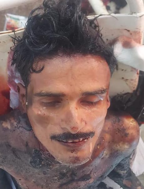 पहचान हेतु आपसे अपील-अज्ञात मृतक व्यक्ति के पहचान हेतु शक्ति पुलिस की अपील, पुलिस थाना शक्ति में है मामला दर्ज,आप भी इस चेहरे को जानते हो तो तत्काल इसकी सूचना दें पुलिस थाने शक्ति में पहचान हेतु आपसे अपील-अज्ञात मृतक व्यक्ति के पहचान हेतु शक्ति पुलिस की अपील, पुलिस थाना शक्ति में है मामला दर्ज,आप भी इस चेहरे को जानते हो तो तत्काल इसकी सूचना दें पुलिस थाने शक्ति में kshititech
