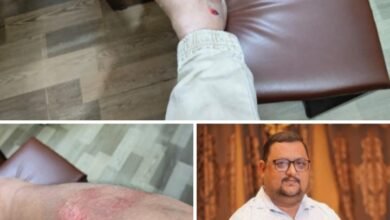 सड़क दुर्घटना में बाल- बाल बचे जनर्लिस्ट वेलफेयर यूनियन के प्रदेश अध्यक्ष अमित गौतम, 6 दिसंबर की रात्रि जल बिहार कॉलोनी रायपुर में तेज रफ्तार कार ने उनकी स्कूटी को मारी जोरदार टक्कर,अमित गौतम ने कहा- ईश्वर की कृपा एवं आप सभी के स्नेह से हूँ सकुशल, हाथ एवं पैर में पहुंची है मामूली चोटें, 9 दिसंबर के अधिवेशन हेतु प्रदेश अध्यक्ष गौतम ने करी पत्रकार साथियों को जांजगीर पहुंचने की अपील kshititech