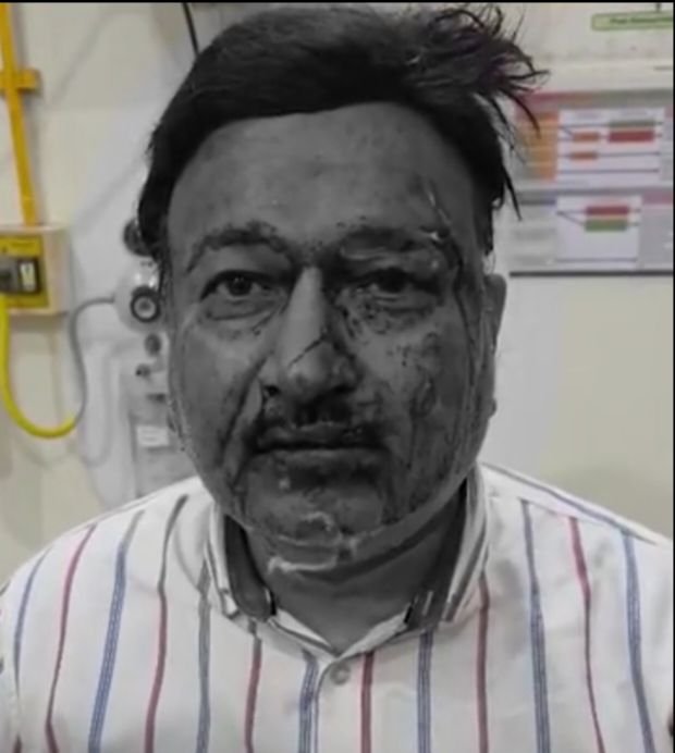 बड़ी खबर- व्यापारी से हुई 20 लाख रुपए की लूट, लुटेरे ने फोड़ा व्यापारी का सर बड़ी खबर- व्यापारी से हुई 20 लाख रुपए की लूट, लुटेरे ने फोड़ा व्यापारी का सर kshititech