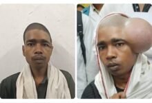 कमाल कर दिया चिकित्सकों की टीम ने-शासकीय चिकित्सा महाविद्यालय, अंबिकापुर में विशाल स्कैल्प डर्मॉइड सिस्ट का सफल ऑपरेशन. मरीजो के परियों ने किया धन्यवाद kshititech