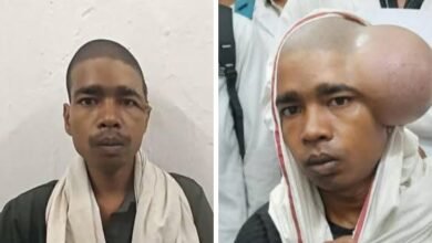 कमाल कर दिया चिकित्सकों की टीम ने-शासकीय चिकित्सा महाविद्यालय, अंबिकापुर में विशाल स्कैल्प डर्मॉइड सिस्ट का सफल ऑपरेशन. मरीजो के परियों ने किया धन्यवाद कमाल कर दिया चिकित्सकों की टीम ने-शासकीय चिकित्सा महाविद्यालय, अंबिकापुर में विशाल स्कैल्प डर्मॉइड सिस्ट का सफल ऑपरेशन. मरीजो के परियों ने किया धन्यवाद kshititech