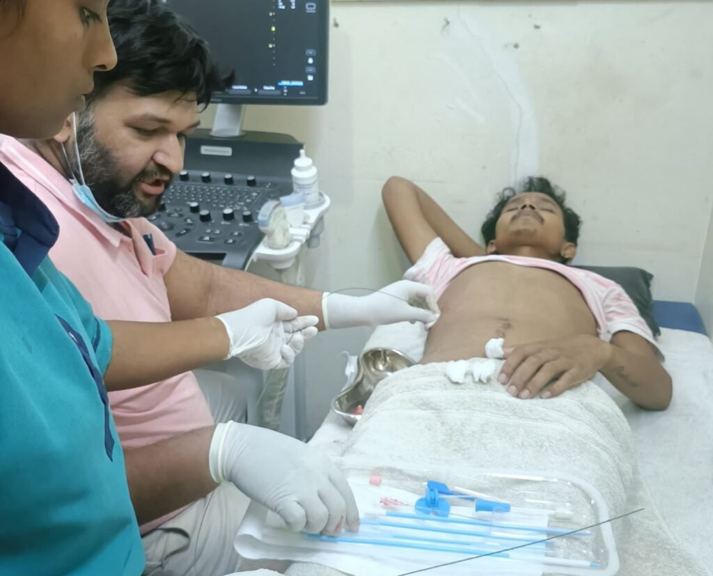 शक्ति के बिहान नर्सिंग होम में सुप्रसिद्ध चिकित्सक डॉ राहुल अग्रवाल ने किया एक्सेस लीवर का बिना चीरा के सफल ऑपरेशन. डॉ राहुल शक्ति क्षेत्र के प्रसिद्ध सर्जन के रूप में बड़े हॉस्पिटलों में भी दे रहे हैं अपनी सेवाएं. पिगटेल कैथेटर तकनीक से हुआ ऑपरेशन kshititech