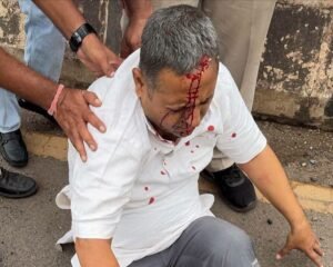 ब्रेकिंग न्यूज़-आम आदमी पार्टी के कार्यकारी प्रदेश अध्यक्ष का वाहन हुआ दुर्घटनाग्रस्त.दुर्घटना में घायल प्रदेश अध्यक्ष को कराया गया अस्पताल में भर्ती ब्रेकिंग न्यूज़-आम आदमी पार्टी के कार्यकारी प्रदेश अध्यक्ष का वाहन हुआ दुर्घटनाग्रस्त.दुर्घटना में घायल प्रदेश अध्यक्ष को कराया गया अस्पताल में भर्ती kshititech