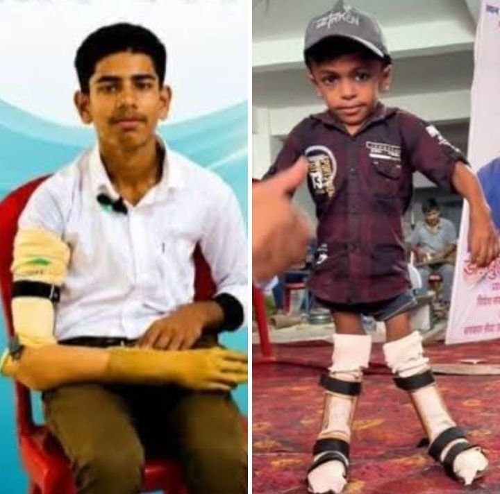 25 से 29 नवंबर तक होगा विकलांगों के लिए कृत्रिम अंग वितरण शिविर- अखिल भारतीय विकलांग चेतना परिषद ने किया है आयोजन. कृत्रिम हाथ-पैर सहित अन्य उपकरणों का भी होगा निशुल्क वितरण. पवन नालोटिया बनाए गए कार्यक्रम संयोजक. राष्ट्रीय पदाधिकारी मदन मोहन अग्रवाल ने दी जानकारी 25 से 29 नवंबर तक होगा विकलांगों के लिए कृत्रिम अंग वितरण शिविर- अखिल भारतीय विकलांग चेतना परिषद ने किया है आयोजन. कृत्रिम हाथ-पैर सहित अन्य उपकरणों का भी होगा निशुल्क वितरण. पवन नालोटिया बनाए गए कार्यक्रम संयोजक. राष्ट्रीय पदाधिकारी मदन मोहन अग्रवाल ने दी जानकारी kshititech