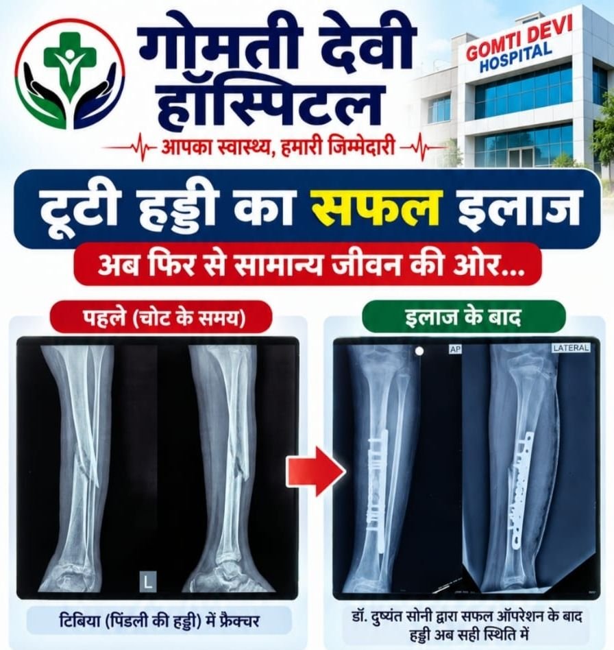 शक्ति के गोमती देवी हॉस्पिटल में अब हो रहा है टूटी हड्डियों का सफल इलाज -प्रसिद्ध ऑर्थो स्पेशलिस्ट की मिलेगी सेवाएं. डिजिटल एक्स-रे की सुविधा सहित आधुनिक मेडिकल उपकरणों से हो रहा इलाज kshititech